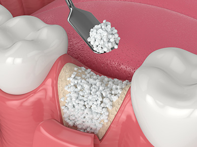 Ditmars Family Dental | Removable Dental Prostheses , Emergency Treatment and Cosmetic Dentistry