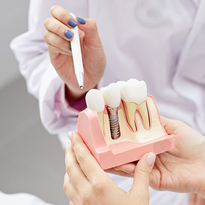 Ditmars Family Dental | Teeth Whitening, Oral Exams and Dentures