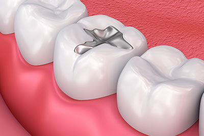 Ditmars Family Dental | Cosmetic Dentistry, Oral Exams and Full Mouth Reconstruction