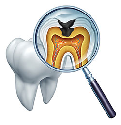 Ditmars Family Dental | Cosmetic Dentistry, Bone Grafts and Bonding