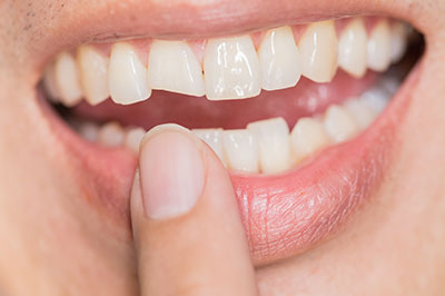 Ditmars Family Dental | Cosmetic Dentistry, Bonding and Implant Dentistry