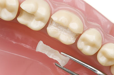Ditmars Family Dental | Veneers, Oral Exams and Cosmetic Dentistry