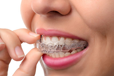 Ditmars Family Dental | Bonding, Crowns and Preventative Program