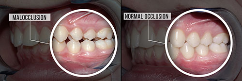 Ditmars Family Dental | Implant Dentistry, Emergency Treatment and Dental Bridges