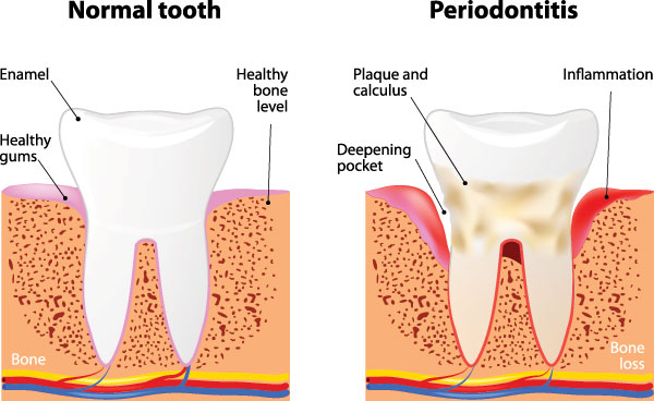 Ditmars Family Dental | Oral Exams, Cosmetic Dentistry and Dental Bridges