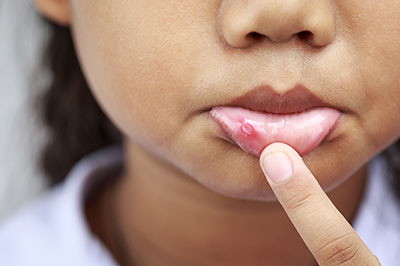 Ditmars Family Dental | Extractions, Cosmetic Dentistry and Dental Bridges