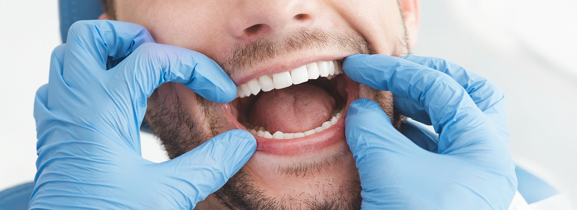 Ditmars Family Dental | Dental Bridges, Crowns and Veneers