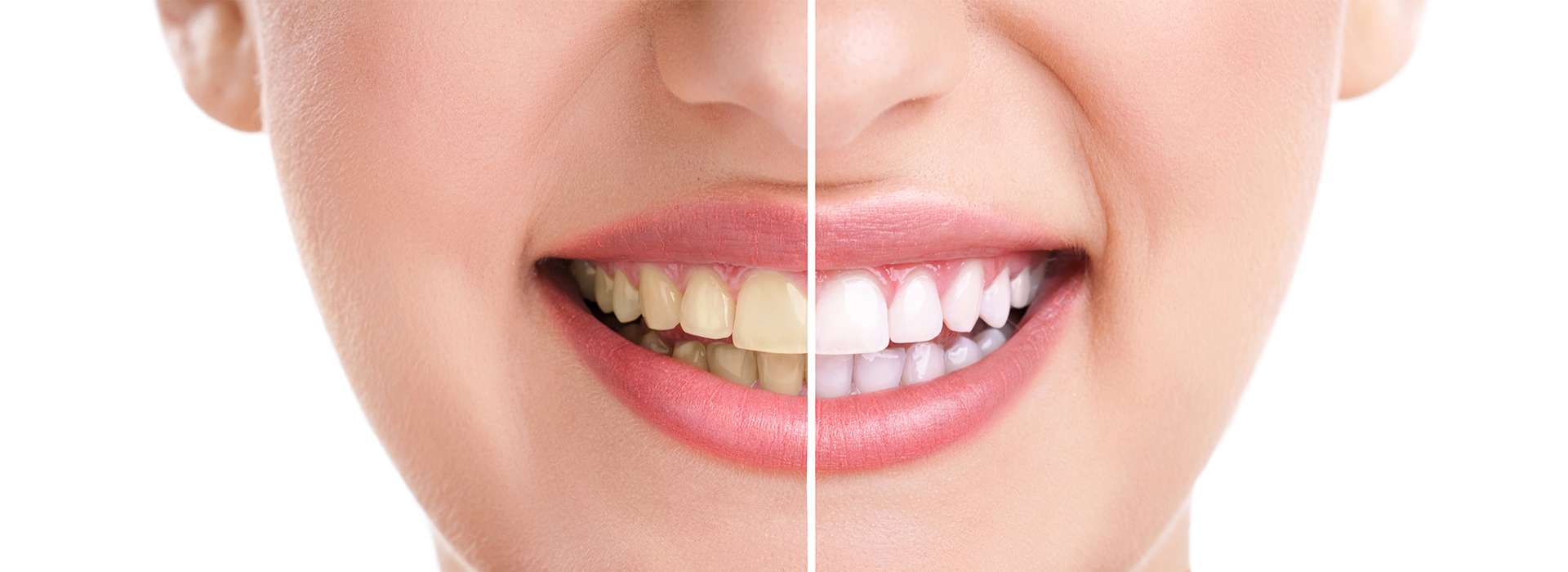 Ditmars Family Dental | Removable Dental Prostheses , Extractions and Implant Dentistry